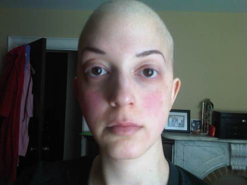 This was pretty much the lowest of the low. Splotchy steroid cheeks and bald as hell and not even able to muster up a fake smile. Yeesh.